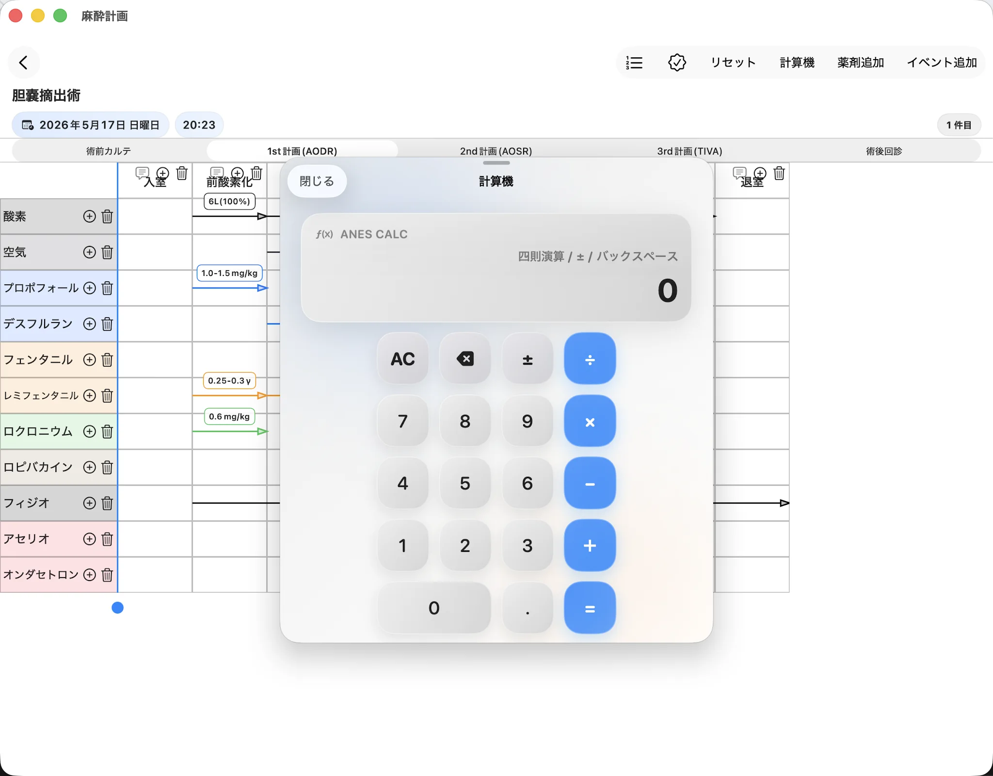 麻酔計画 — 計画画面から計算機へ